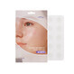 Ultradunne hydrocollo&#239;dale anti-acne pleisters met uienextract, 15 stuks, Isntree