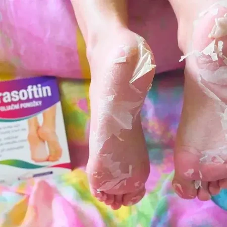 Parasoftin Peelingsocken, 1 Paar, Zdrovit