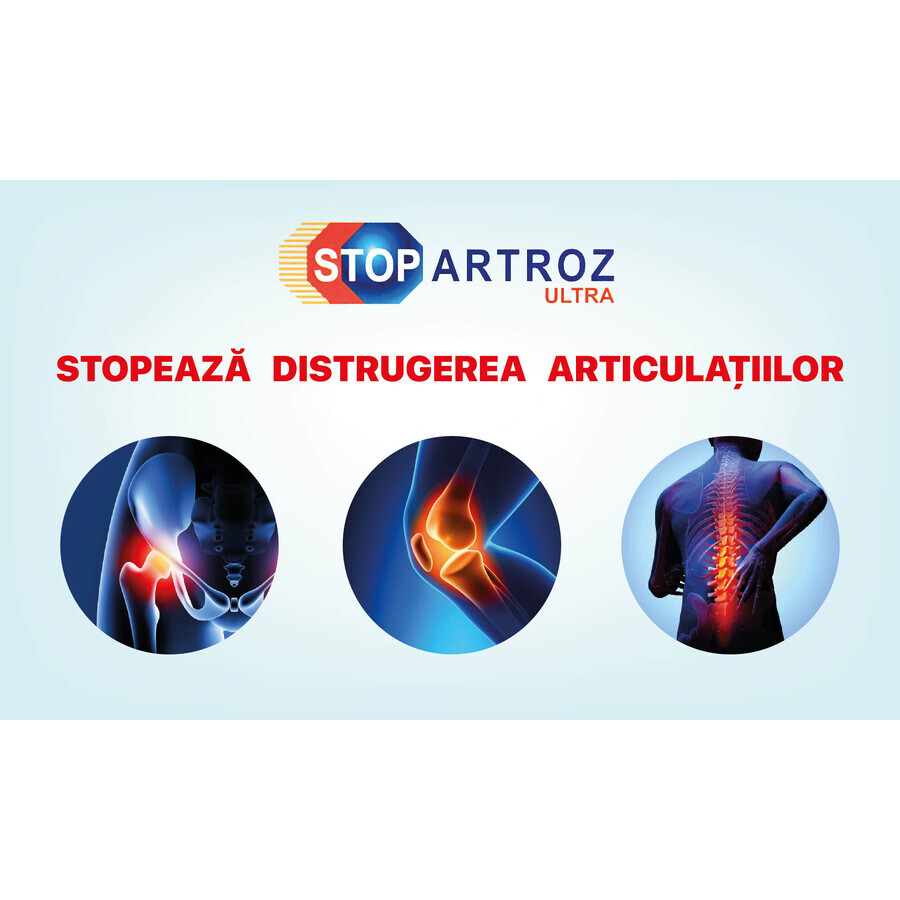 Stopartroz Ultra, 30 Beutel, Rompharm