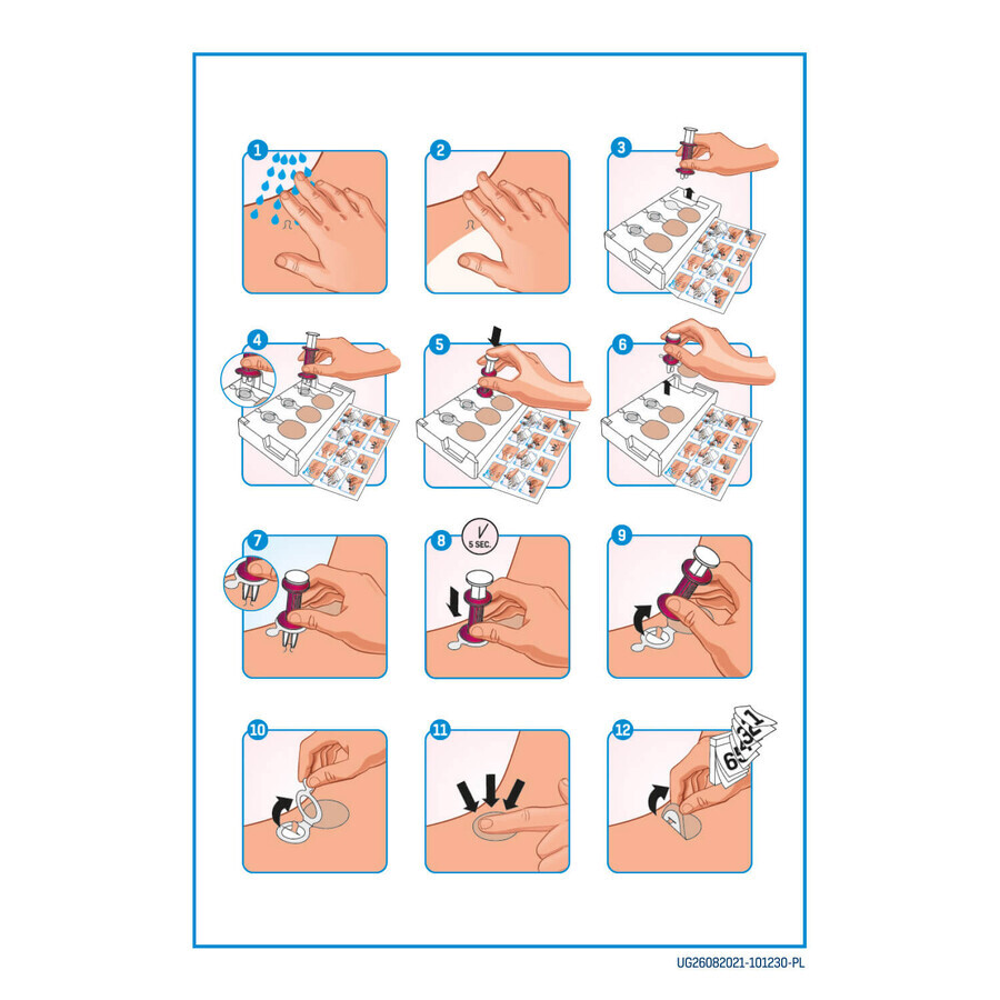 Fibrocontrol, set voor de behandeling van huidfibromen, pleisters + applicator