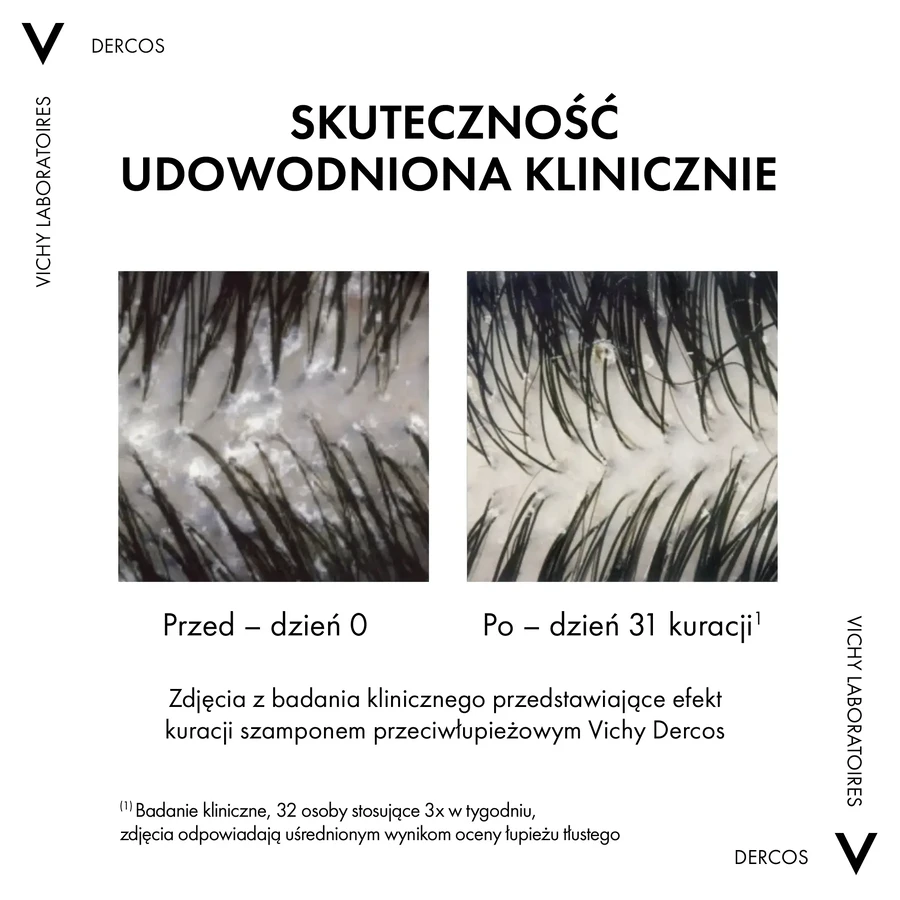 Vichy Dercos Szampon łupież suchy 390ml: ceny i cechy