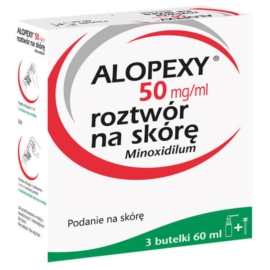 Alopexy 5 % (50 mg/ml) oplossing voor toepassing op de huid, 3 x 60 ml