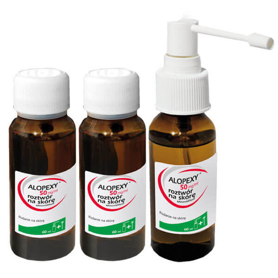 Alopexy 5 % (50 mg/ml) oplossing voor toepassing op de huid, 3 x 60 ml