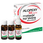 Alopexy 5 % (50 mg/ml) oplossing voor toepassing op de huid, 3 x 60 ml