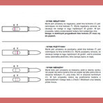 L-Check-1 Midstream Ovulatietest, 1 verpakking (5 testen)