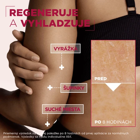 Mixa Urea Cica Repair+ pielęgnacja regenerująca do skóry bardzo suchej i szorstkiej, 400 ml: ceny i cechy