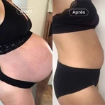 Omum Duo In&Out Stretch Marks I uitgerust