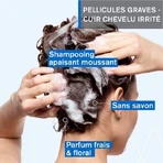 Uriage D.S Shampooing Traitant Keratoreducteur Hair 150 ml
