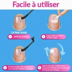 Excilor Nagelschimmel Behandeling Sterk 30ml