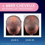 Arkopharma Forcapil Elixir Crecimiento Cheveux Clairsemés 50ml