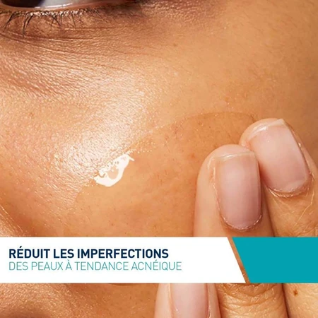 Cerave Concentrado Facial Anti-Imperfecciones Pieles con imperfecciones y tendencia acneica 40ml