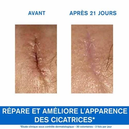 Uriage Bariéderm-Cica Repair Cream Met Cu-zn Bariederm Geïrriteerde Huid Peaux Fragilisees 100ml