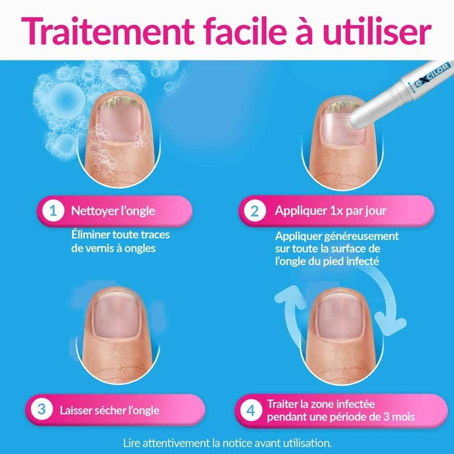 Excilor Applications of antifungal stylet 400 4ml