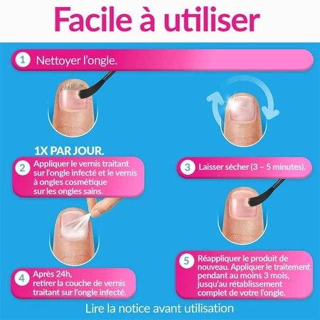 Excilor Nagelschimmelbehandeling Sterk Naakt 30ml