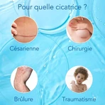 Kelo-cote Gel de silicona para cicatrices 60g