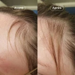 Omum Mon Coup de Pousse Nutricosmétique 60 cápsulas