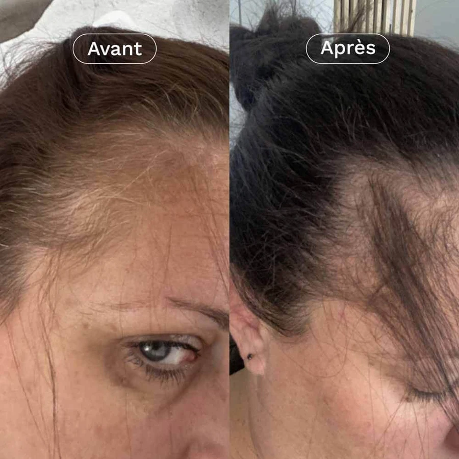 Omum Mon Coup de Pousse Nutricosmétique 60 cápsulas