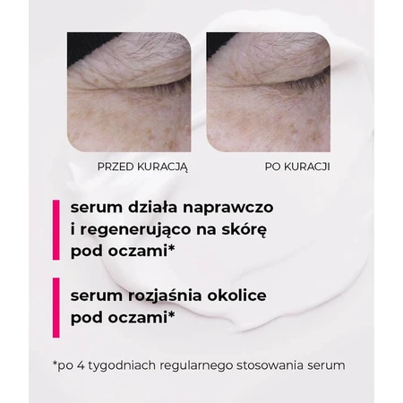 Veoli Botanica 20 Seconds Magic Eye Treatment, liftingująco-naprawcze serum pod oczy i na powieki, 15 ml: ceny i cechy