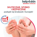 Help4Skin Warzen und Dornwarzen, Aerosol, 50 ml