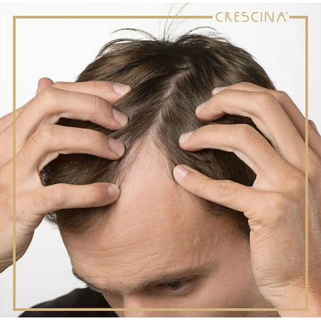 Labo Caducrex Caducrex Transdermic HFSC Haar Ampulle für Haarausfall für Männer 20x3.5ml
