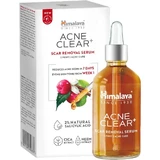 Himalaya Acne Clear+ Serum voor acnelittekens 30 ml