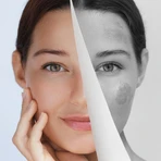Miraculum Anti-Pigmentation, crème de nuit éclaircissante, 50 ml
