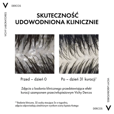 Set Vichy Dercos DS, antiroosshampoo, normaal en vet haar, 390 ml + navulverpakking, 390 ml