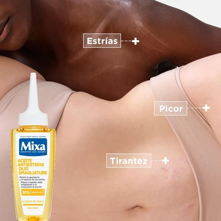 Mixa Anti-stretch mark olie tegen tekenen van zwangerschap of gewichtsverandering 100 ml
