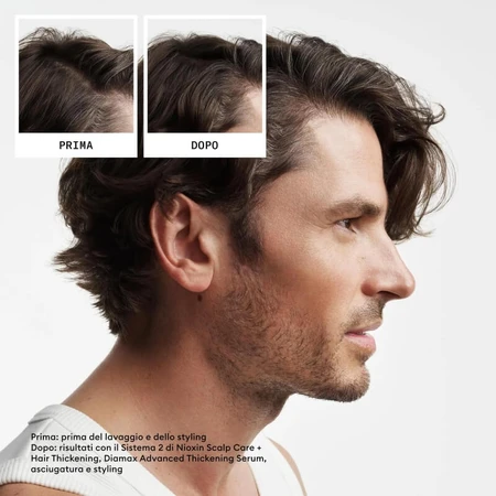 Nioxin System 2 kit - volumizing shampoo 300 ml + conditioner 300 ml + treatment 100 ml box set