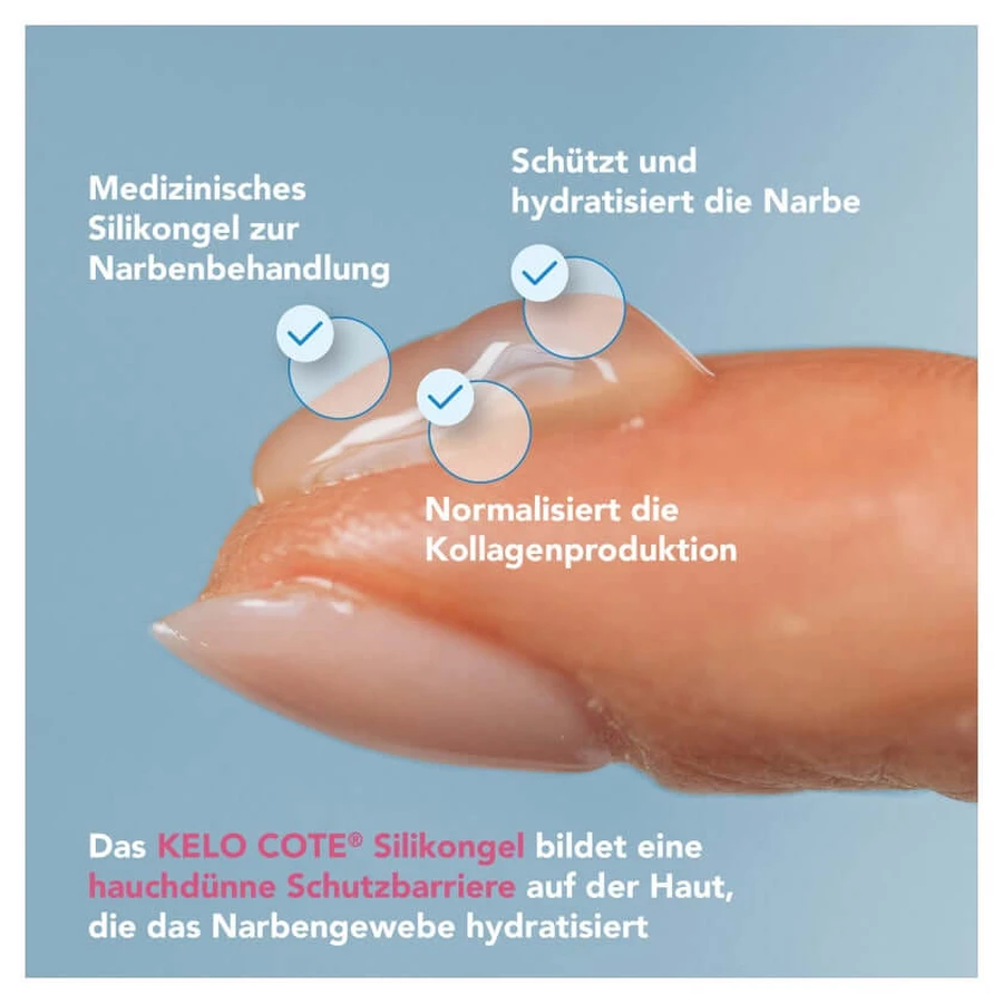 Kelo-cote silicone gel for the treatment of scars 6 g