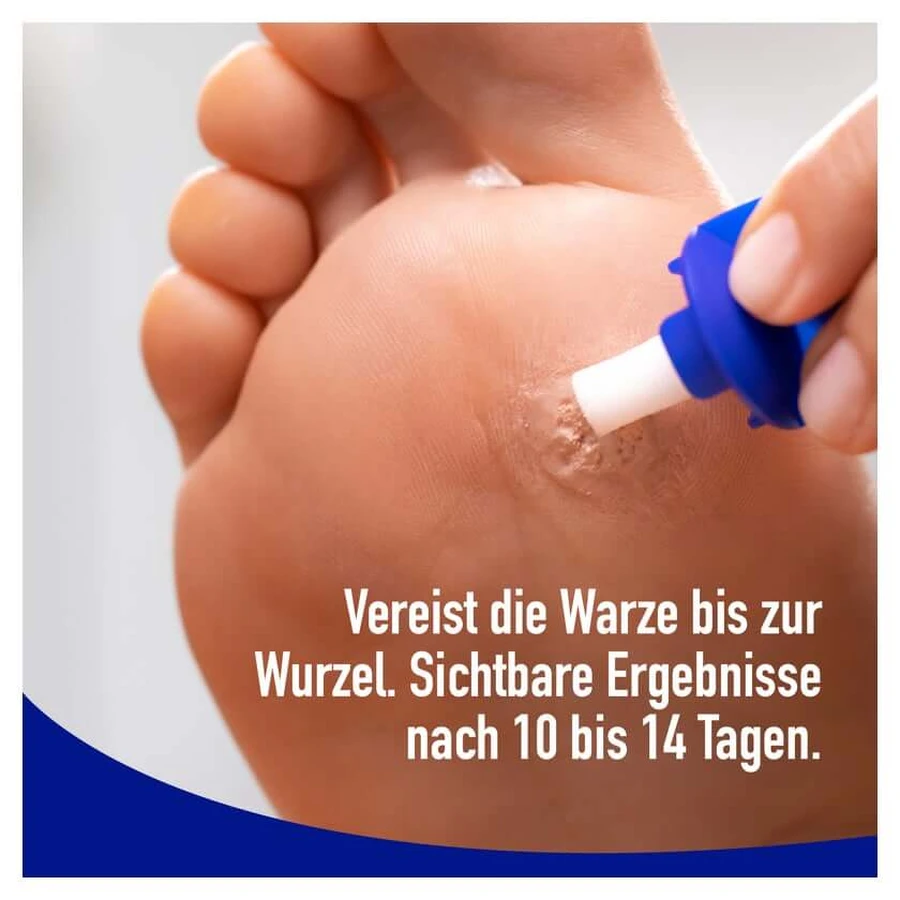 Wartner Plantar Wart Spray 50 ml