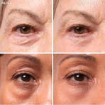 It Cosmetics Bye Bye Under Eye Bag – Augencreme 15 ml