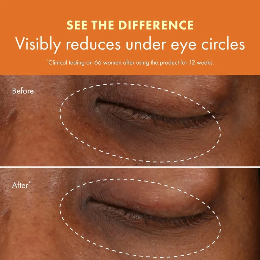 Origins Ginzing Brightening Eye Cream – krem pod oczy 15 ml – w wersji „Warm”: ceny i cechy