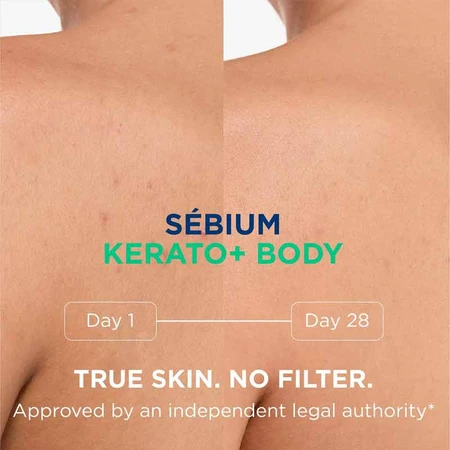 Sebium Kerato+ Body Spray, 2 x 150 ml, Bioderma 