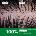 Vichy Dercos Shampooing Anti Pelliculaire Cheveux Normaux à Gras 2x390 ml