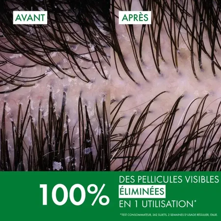 Vichy Dercos Shampooing Anti Pelliculaire Cheveux Normaux à Gras 2x390 ml