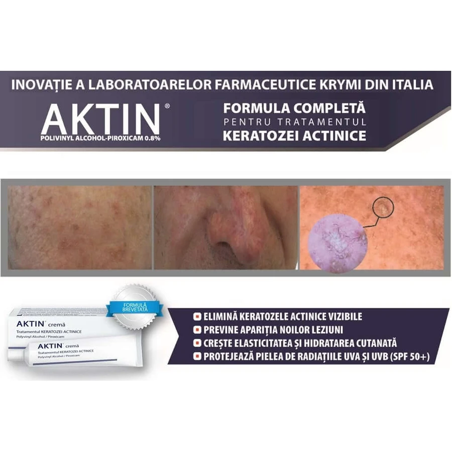Krem do leczenia rogowacenia słonecznego i zmian nowotworowych Aktin, 30 ml, Solartium: ceny i cechy